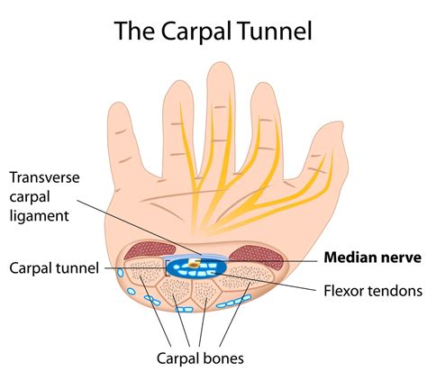 What Is Carpal Tunnel Syndromedoctorstep