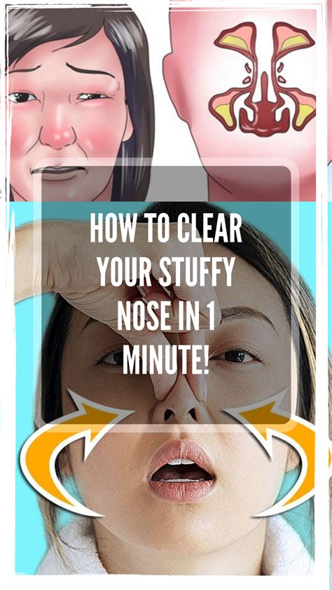How To Clear Your Stuffy Nose In 1 Minute Stuffy Nose Nose Clear