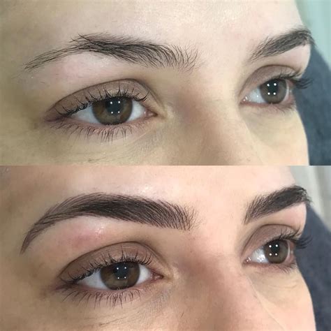 Eyebrow Tattooing Feather Vs Powder Vs Ombre Injex Clinics
