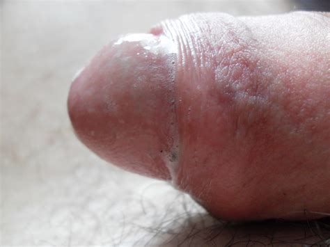 24 In Gallery Close Up Of My Cock Head With Pre Cum