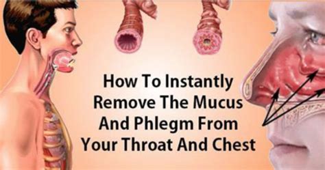 How To Eliminate Mucus And Phlegm From Your Throat And Chest Instant