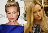 Portia De Rossi before and after plastic surgery – Celebrity plastic ...