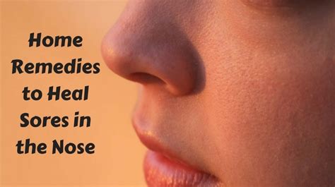Home Remedies To Heal Sores In The Nose