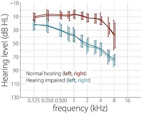 Hearing Levels Of Participants At Different Frequencies Prior To