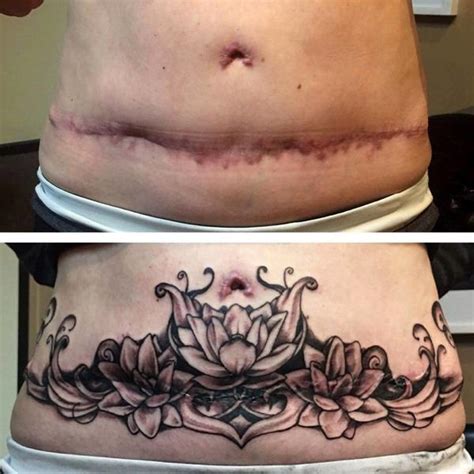 Tummy Tuck Tattoo Cover Ups Pictures Tummy Tuck Prices Photos