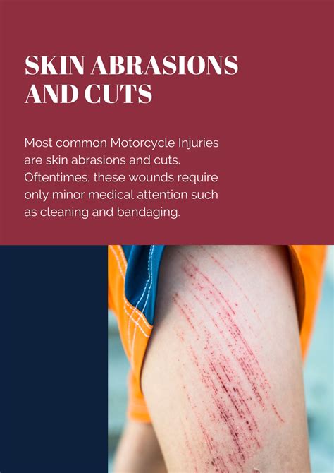 Ppt 5 Most Common Motorcycle Injuries Georgelis Injury Law Firm