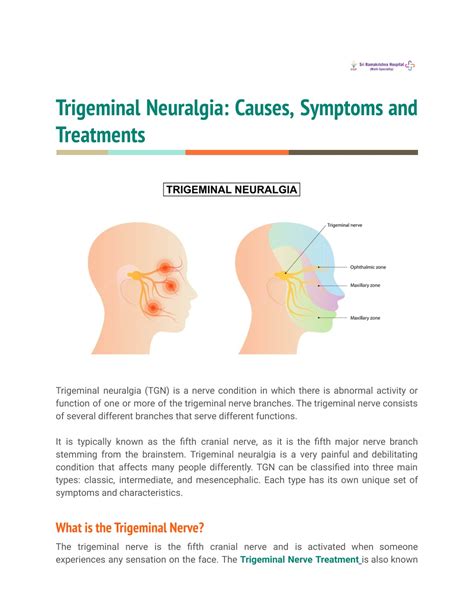 Ppt Trigeminal Neuralgia Causes Symptoms And Treatments Powerpoint
