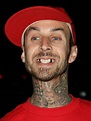 Travis Barker Photos Plastic Surgery Before and After