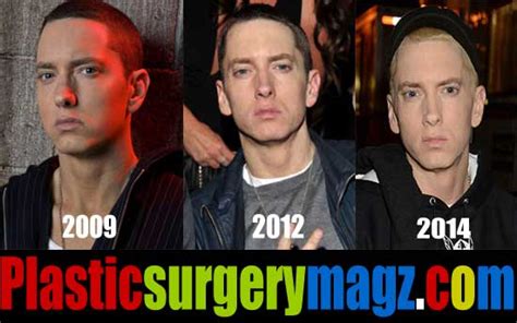Eminem Plastic Surgery Before And After Plastic Surgery Magazine
