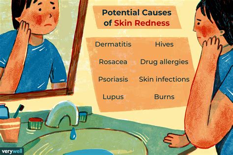 Causes Of Skin Redness