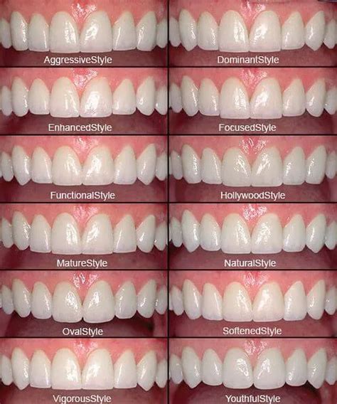 Dental Crowns In Turkey Premium Selections Premium Dental Crowns