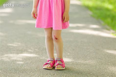 Toddler Girl With Abrasion Knee Skin Standing On Asphalt Sidewalk At