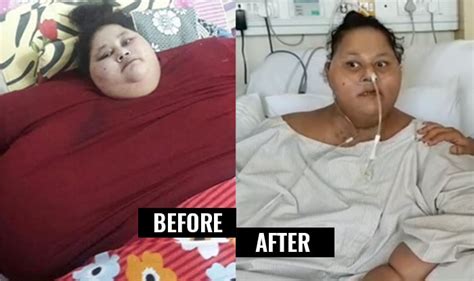 Eman Ahmed ‘former Worlds Heaviest Woman Recovering Well Hospital Shares Videos Of Slimmer