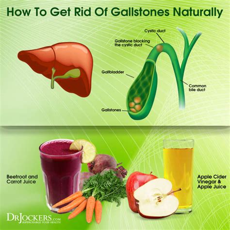 How Do You Get Stones In Your Gallbladder Gallstones Types Treatment