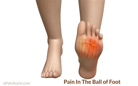 Diagnosis Foot Pain Diagnosis