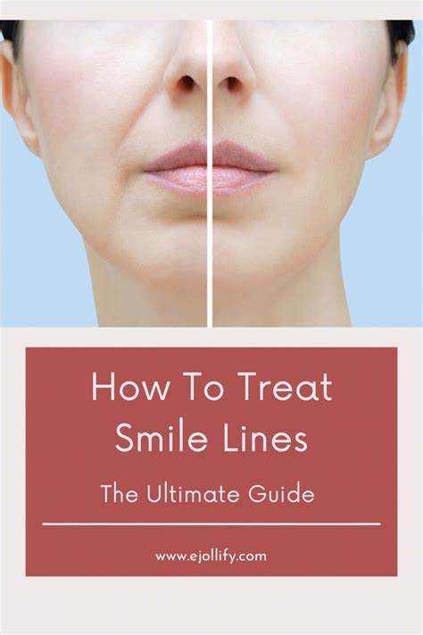 How To Get Rid Of Smile Lines Treatments And Skincare In 2021 Smile