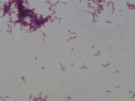 Microbiology Are Acid Fast Bacteria Gram Positive Or Gram Negative