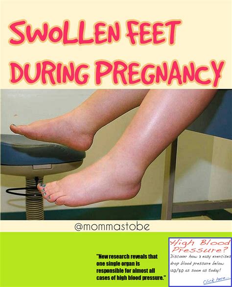 Symptoms Of Edema During Pregnancy Pregnancysymptoms