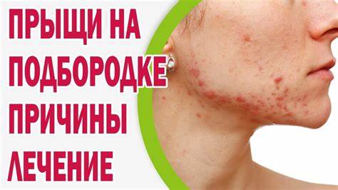 Убрать целлюлит на попе и ягодицах