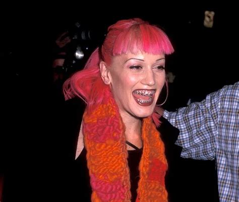 Gwen Stefani Before And After Plastic Surgery Boob Nose Face