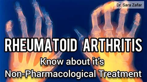 Rheumatoid Arthritis Ra Non Pharmacological Treatment Of Rheumatoid