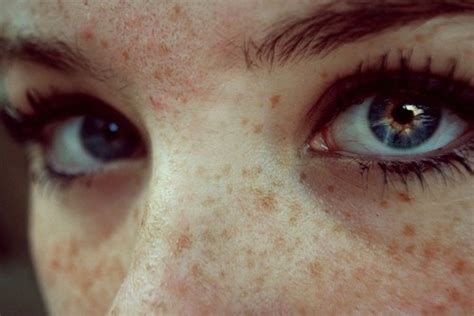 Freckles Freckles Beautiful Eyes Eyes
