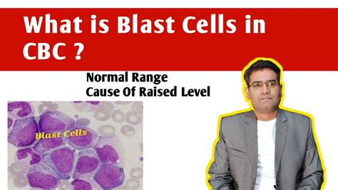 What Is Blast Cells In CBC Normal Range Causes Of High Blast In