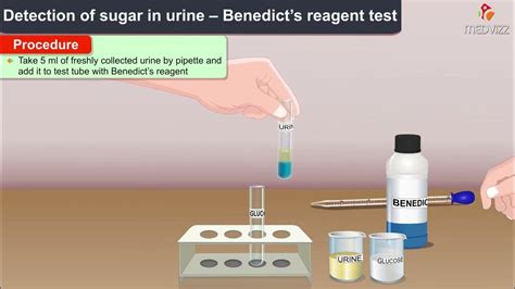 Benedicts Test For Reducing Sugars Youtube