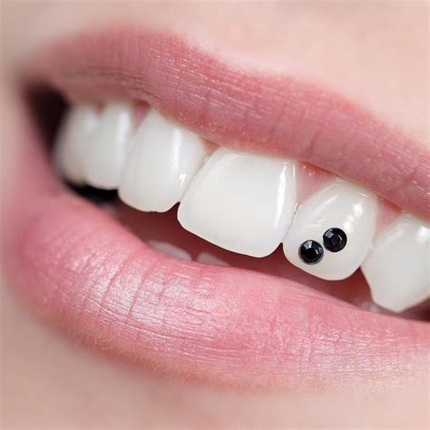 Tooth Gems Dazzling Smile Enhancement Orange County