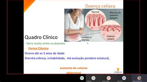 Aula Encontro Patologia Geral Biomedicina Youtube