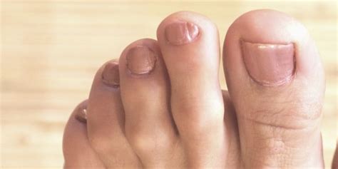 Your Weird Pinky Toenail And Youre Not Alone Uglee Feet