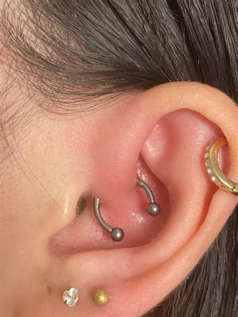 Daith Infection Rpiercing