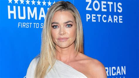 The Cosmetic Procedures Denise Richards Admits To Getting