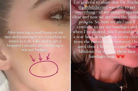 Khloe Kardashian reveals cancer scare; love 10