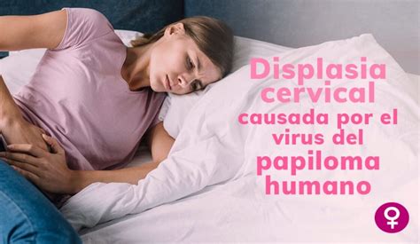 Displasia Cervical Causada Por El Virus Del Papiloma Humano 1 Oncogyn