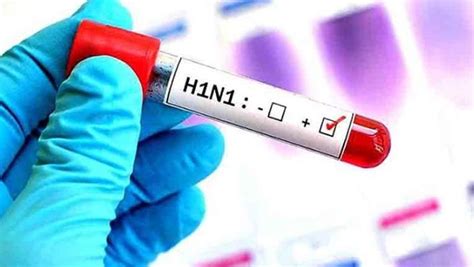 4º Caso De H1n1 é Confirmado Em Não Me Toque Poder Executivo De Não Me Toque