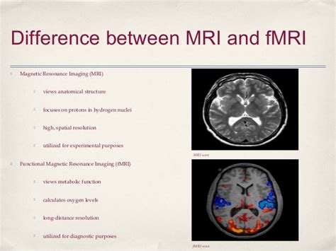What Are Different Types Of Mri Scans Know The Difference