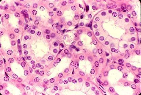 An Image Of Some Pink And Purple Cells