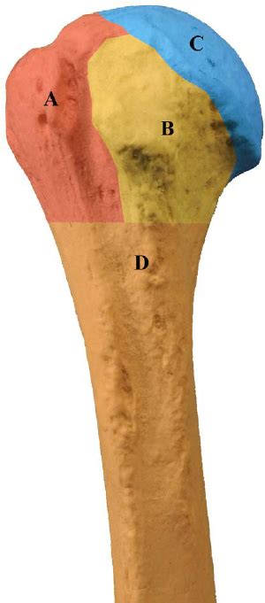 The 4 Parts Of The Proximal Humerus As Described By Codman 82 A