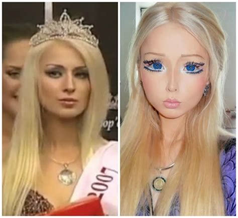 Human Barbie Plastic Surgery Before And After