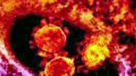 Cdc Confirms First Case Of Deadly Mers In America Fox News Video