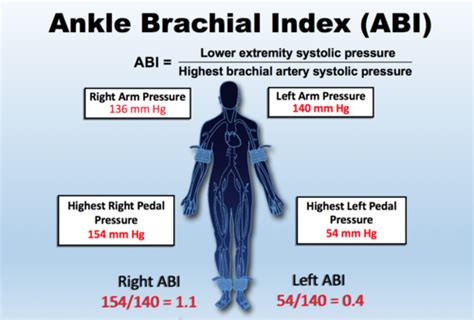 How To Calculate Ankle Brachial Pressure Index The Test Is Performed