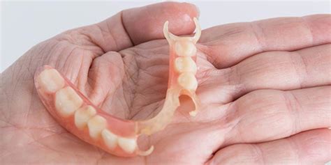Flexible Dentures Full Partial Upper Lower Cost Advantages