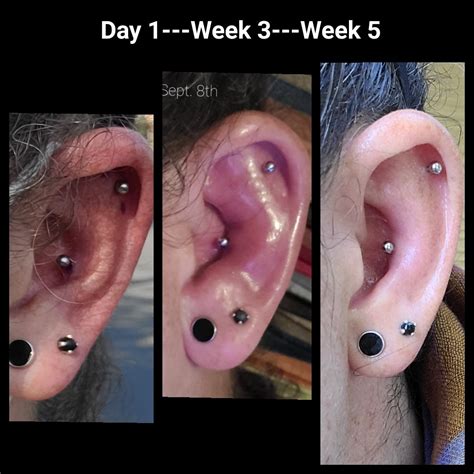 Conch Piercing Pre Post And During Infection Piercing