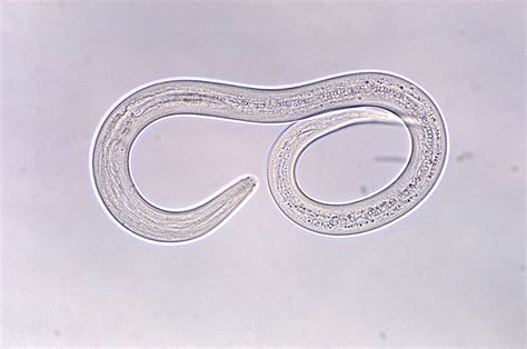 Public Domain Picture Hookworm Filariform Larva Id 13523561416468