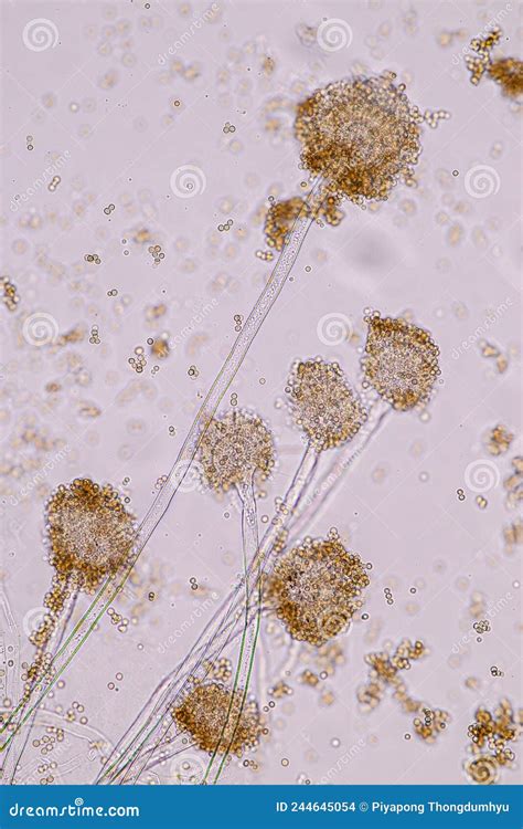 Aspergillus Niger And Aspergillus Oryzae Mold Under Microscope Stock