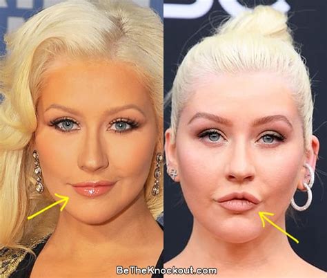 Christina Aguilera Plastic Surgery Comparison Photos