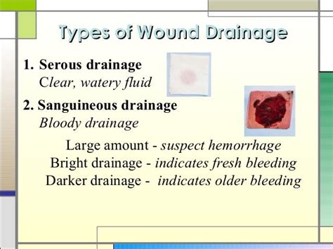 Types Of Draiange From Wounds Wound Healing Nursing Wound Care