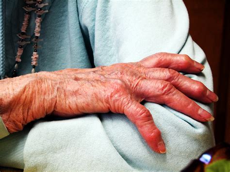 What Do You Want A Picture Of A 91 Year Old Womans Hands Flickr