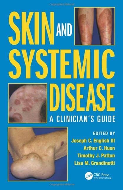 Skin And Systemic Disease A Clinicians Guide Pdf